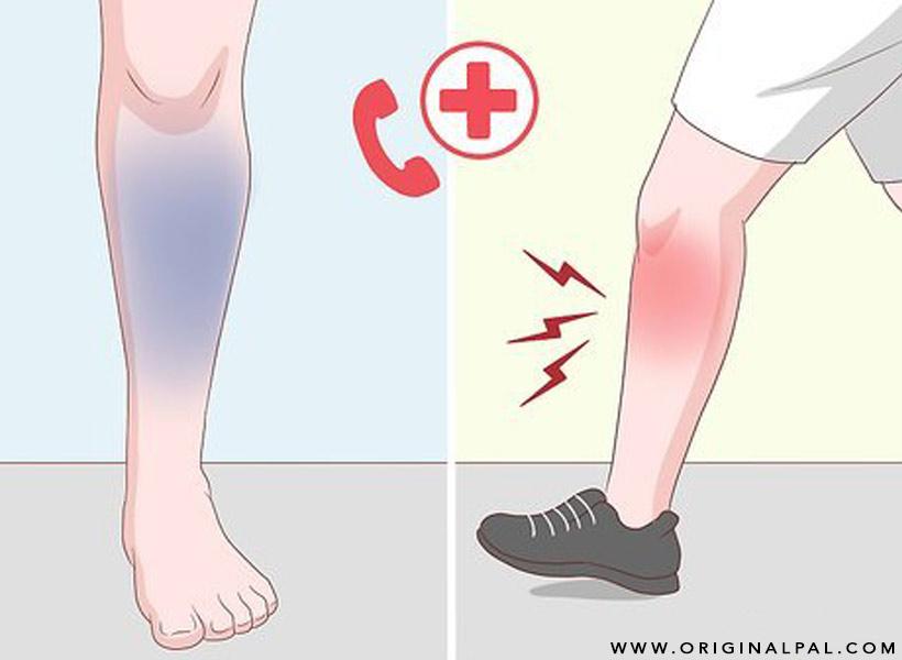 علت درد ساق پا چیست